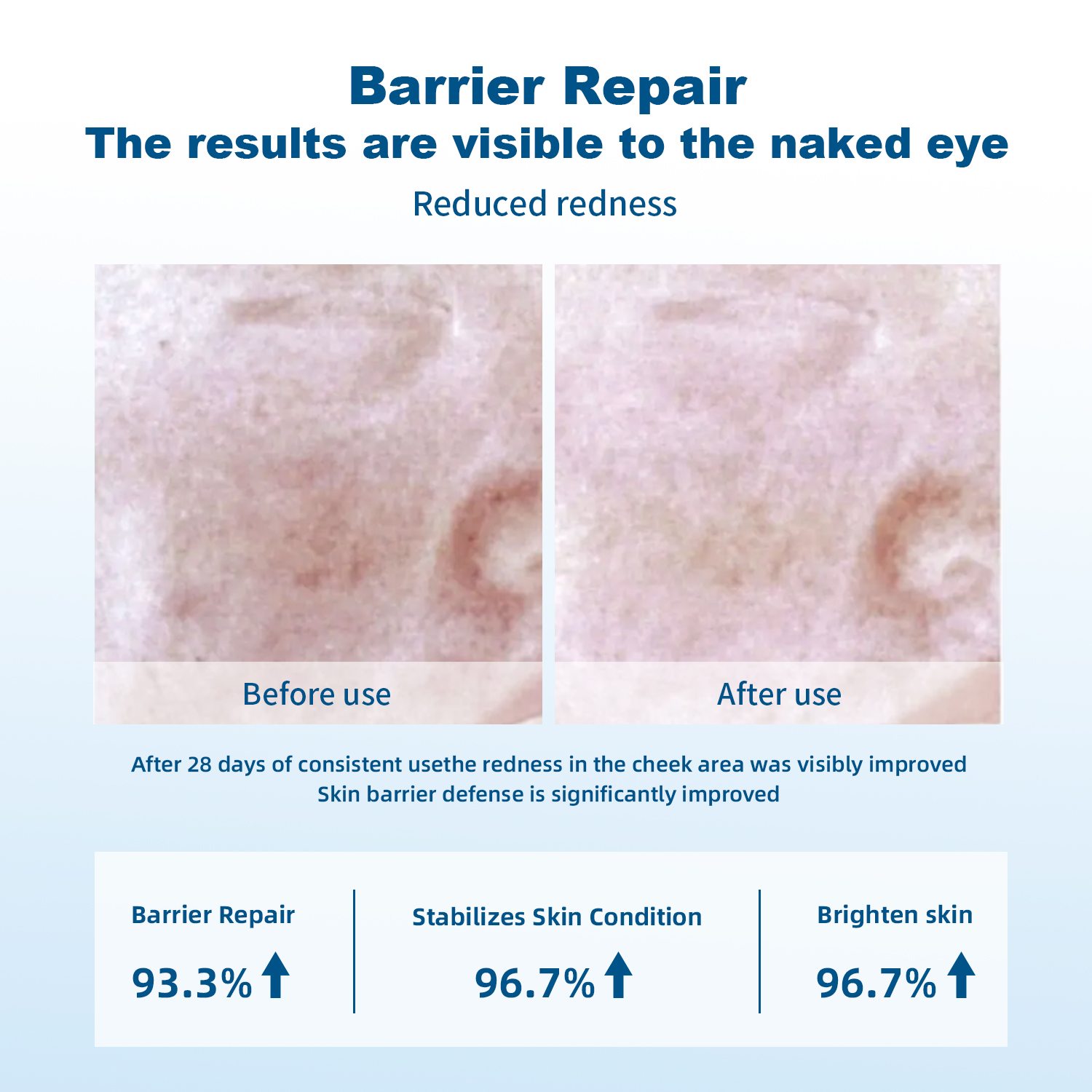 Medical-Grade Recombinant Human Collagen Repair Spray6