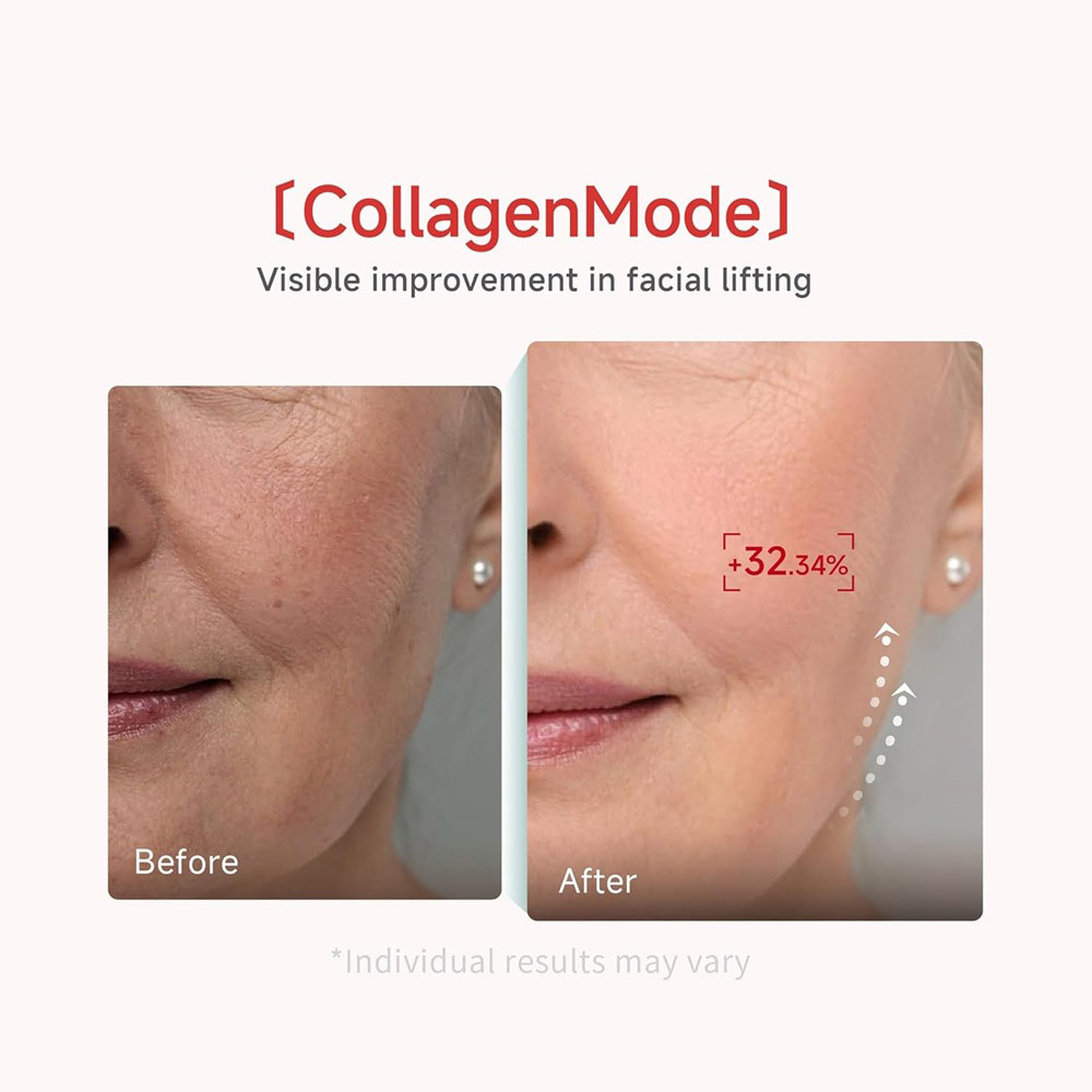 Recombinant-Collagen-Anti-wrinkle-Serum2