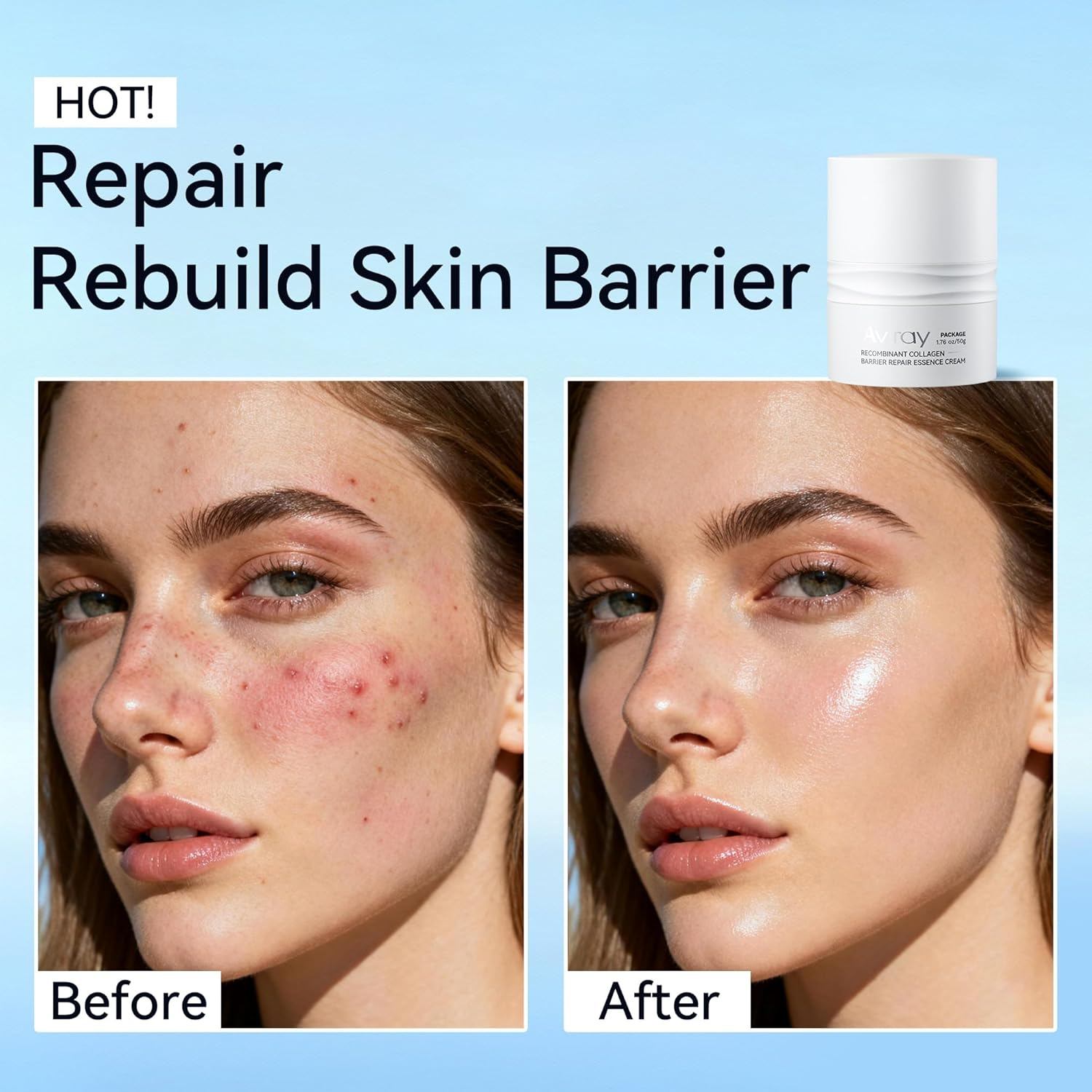 Recombinant Collagen Barrier Repair Cream5
