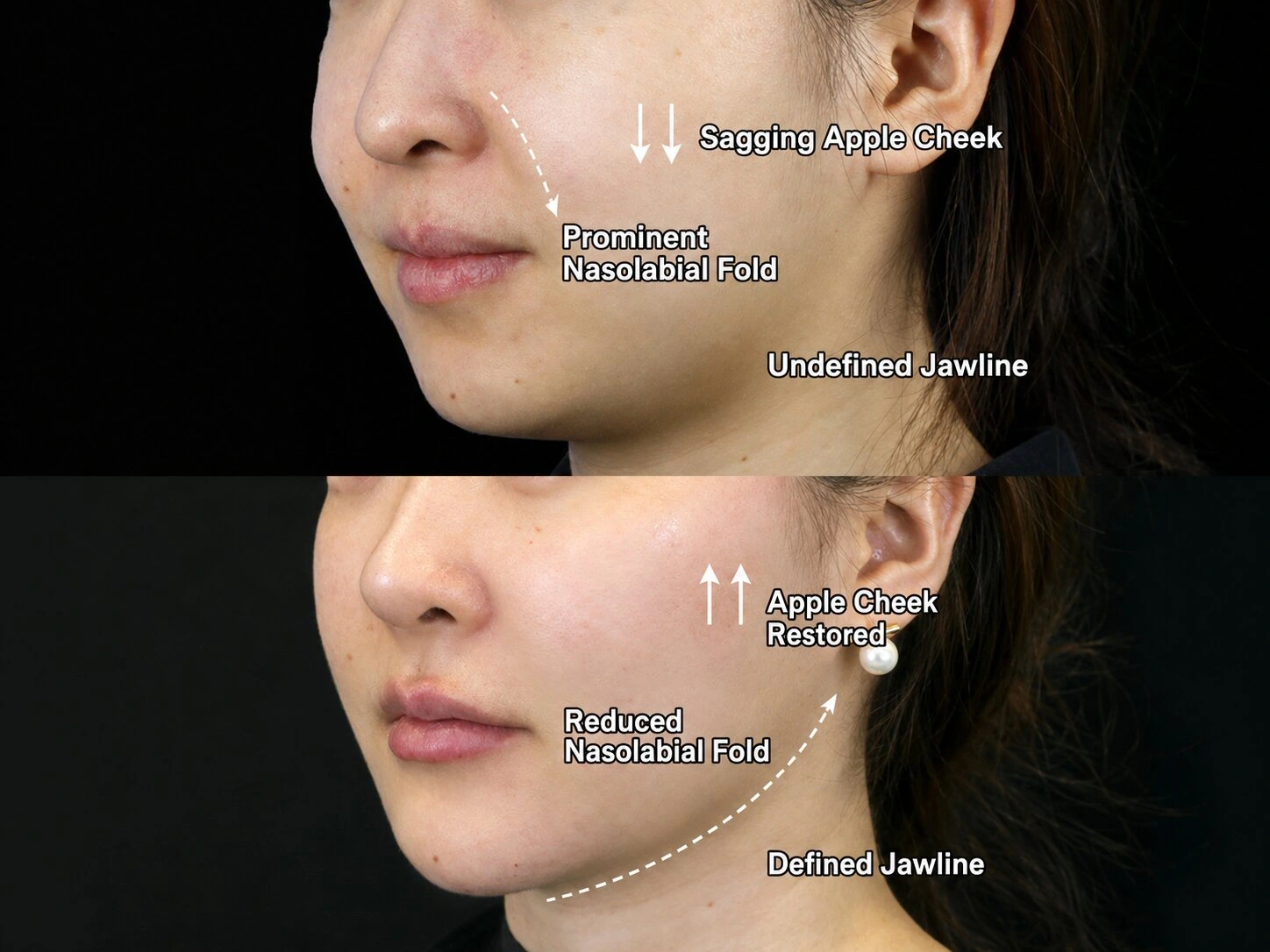 Skin Firming and Anti-Aging Case Study